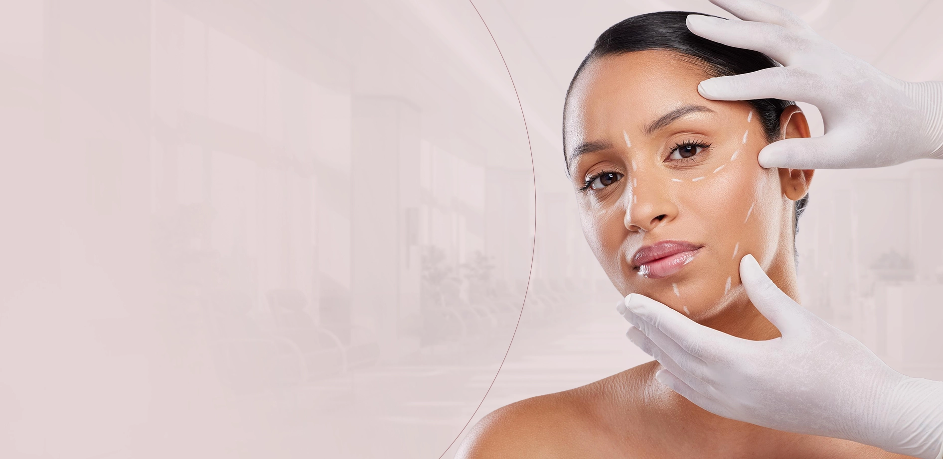 Harmonização Facial com resultado natural - Dra. Anna Malgarise